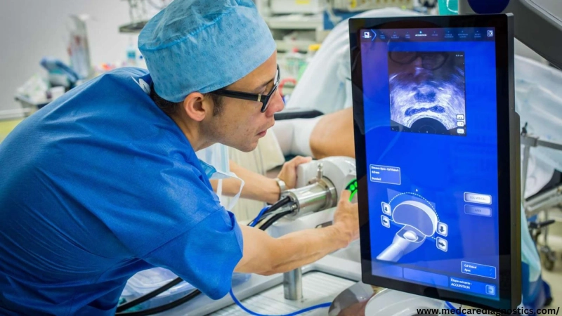 Prostate Cancer Treatment In Mumbai – Medcare Diagnostic