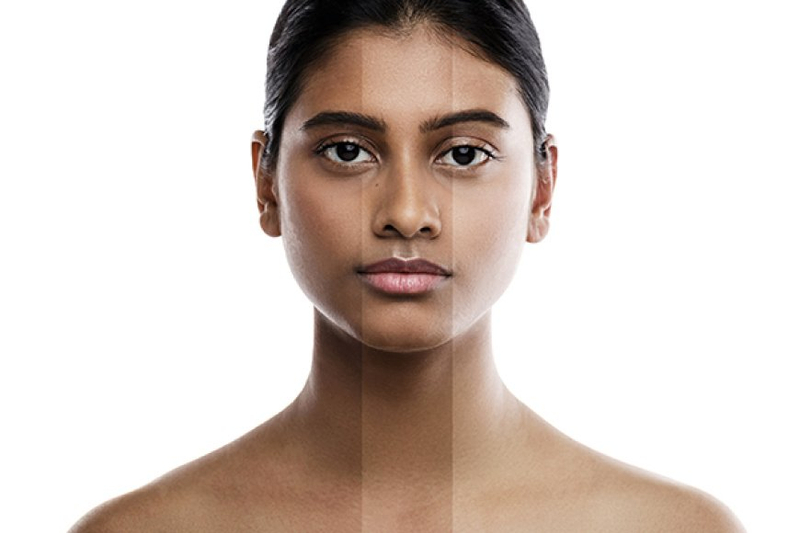 Understanding Melanin and Its Overproduction by Dr Hera's Skin & Hair Clinic