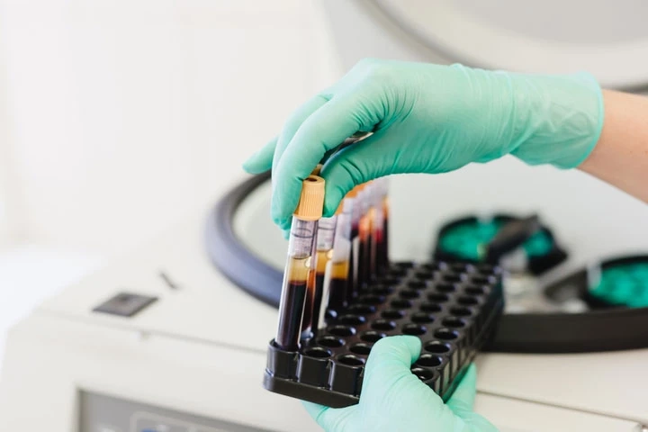 Plasma Fractionation Market Growing Impressive Business Opportunities, Industry Trends, Demand, Future Scope