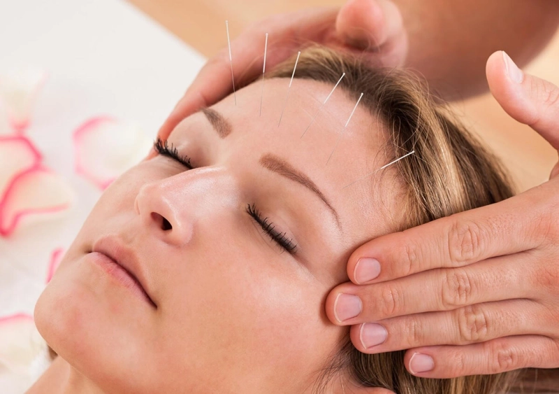 10 Trusted Facial Acupuncture Providers for Holistic Skin Health in NYC