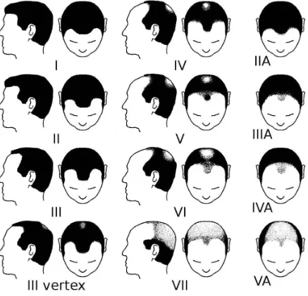 UK Hair Transplant Clinics Manchester: Complete Guide to Choosing the Right Treatment