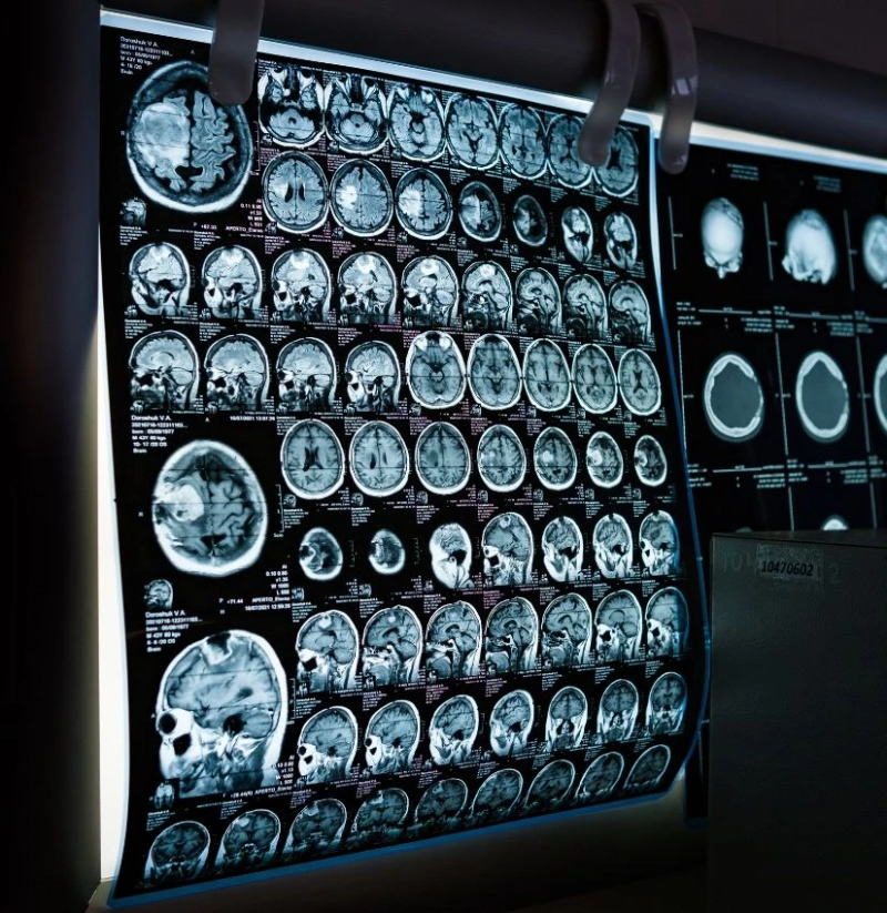 Which MRI Centres Near Me Have the Latest Technology?