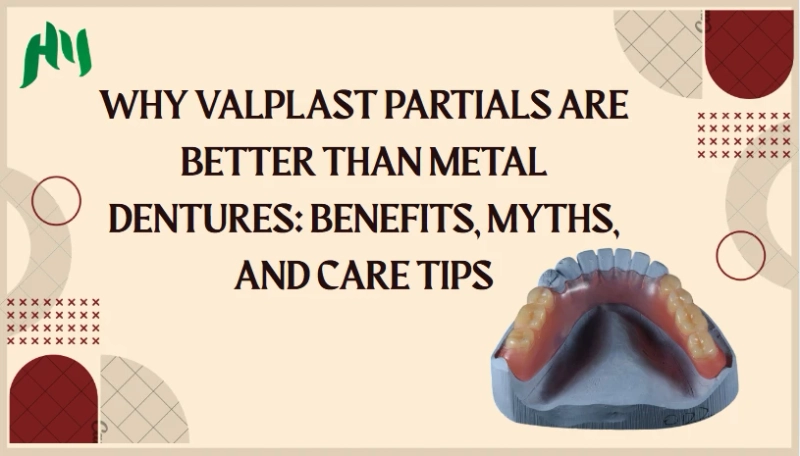 Why Valplast Partials are Better than Metal Dentures: Benefits, Myths, and Care Tips