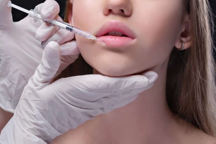 Your Complete Introduction to Dermal Fillers in Wimbledon