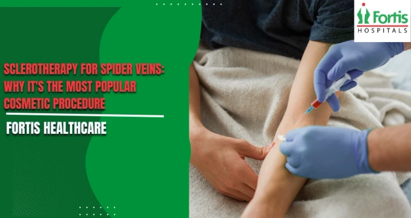 Sclerotherapy for Spider Veins: Why It's the Most Popular Cosmetic Procedure