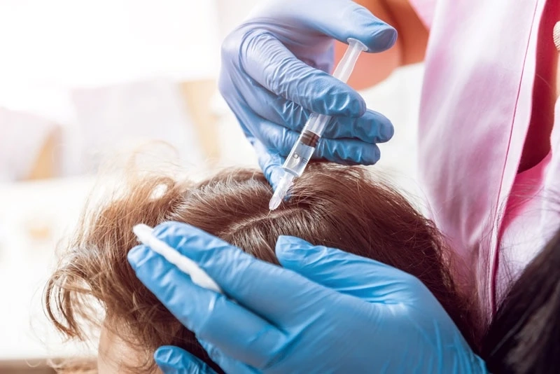 PRP Therapy for Hair Loss: Safe, Natural, and Effective Regrowth Without Surgery