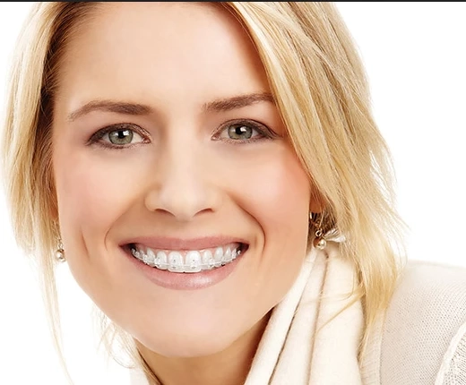 Customized Braces Options for Every Patient in Cerritos