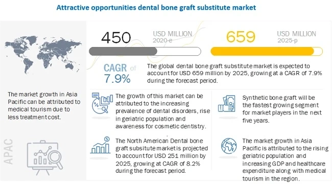 Dental Bone Graft Substitute Market: Continuous Product Commercialization Advancing The Market