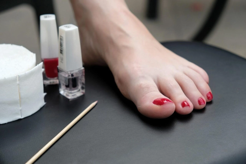 Stepping into Clarity: Long-Term Strategies for Toenail Fungus Prevention and Maintenance