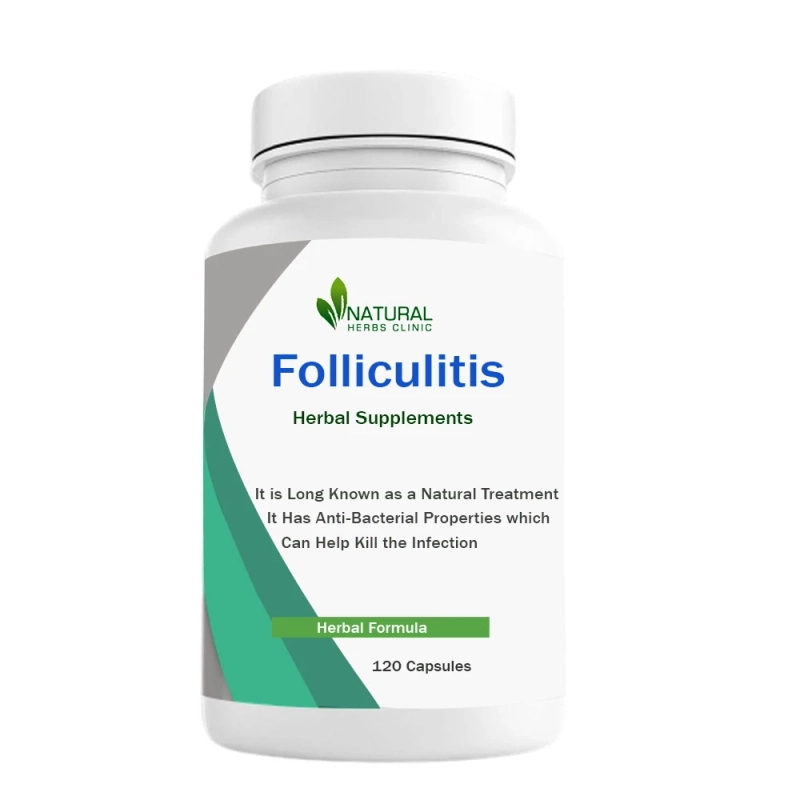 Herbal Treatment for Folliculitis | Natural Remedies | Natural Herbs Clinic