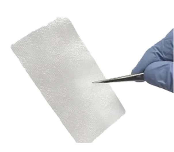 Healing Horizons: How Amniotic Allografts Are Transforming Wound Care