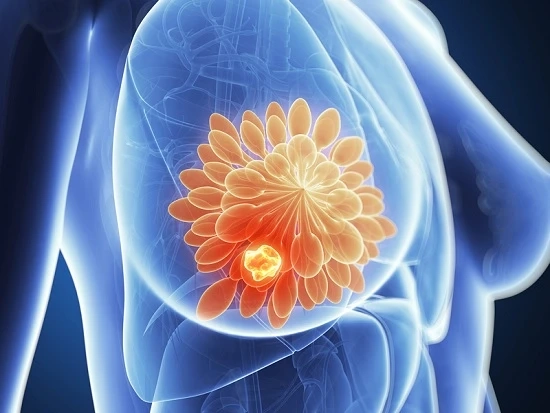 How to Identify Breast Cancer Symptoms in Men