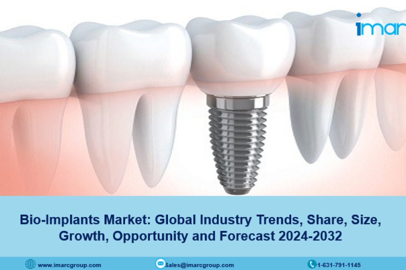 Bio-Implants Market Report, Growth, Size, Trends & Opportunities 2024-2032