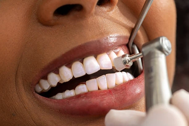 Your Guide to Finding Quality Dental Care with a Clarkston MI Dentist