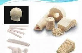 Spinal Machined Bone Allograft Market Innovative Strategy By 2030 | GET FLAT 20% OFF ON THIS REPORT