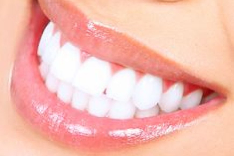 Brighten Your Smile with Teeth Whitening in Rochdale