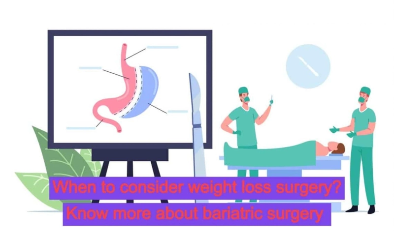 When to Consider Weight Loss Surgery? Know more about Bariatric Surgery