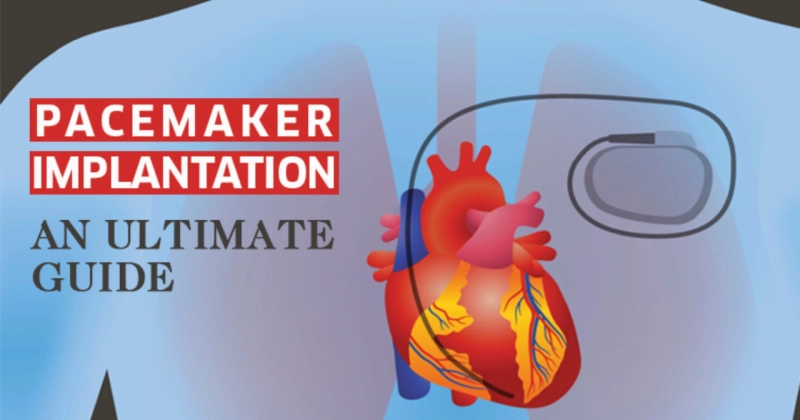 Symptoms to Get Pacemaker - Indore Cardiologist