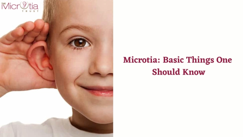Microtia: Basic Things One Should Know
