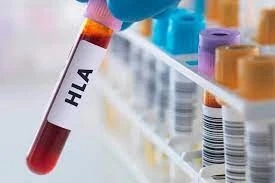 HLA Typing Market Size Forecast to 2031
