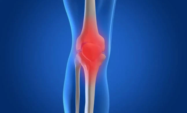 Stem Cell Treatment for Osteoarthritis in Delhi