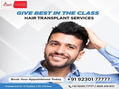How Much Does a Hair Transplant Cost? Exploring the Price Factors