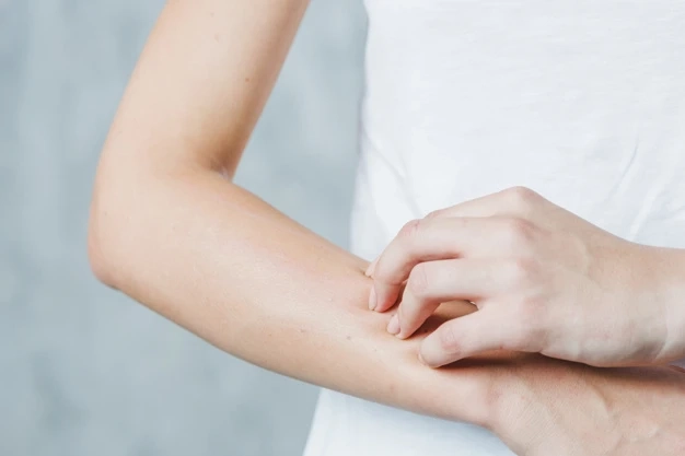 What Are Some Effective Treatments For Dry Skin?