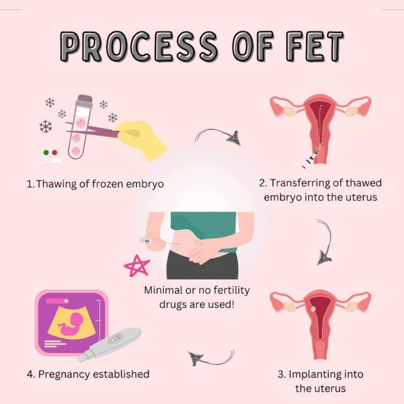 What is Frozen Embryo Transfer (FET)?