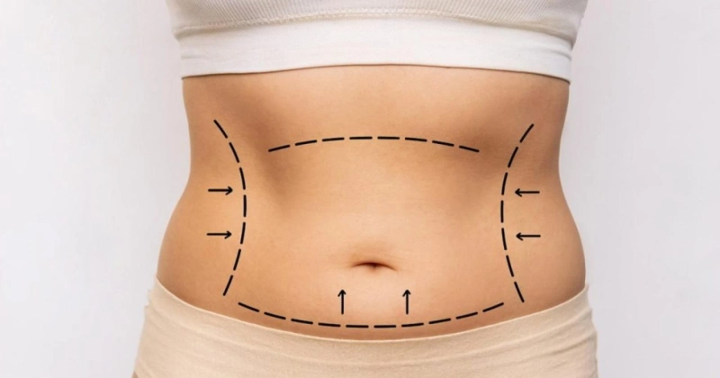 Your Journey to a Flatter Abdomen Starts Here