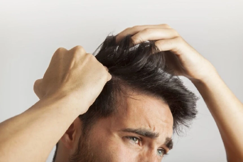 Best Hair Loss Treatment Doctor in Delhi