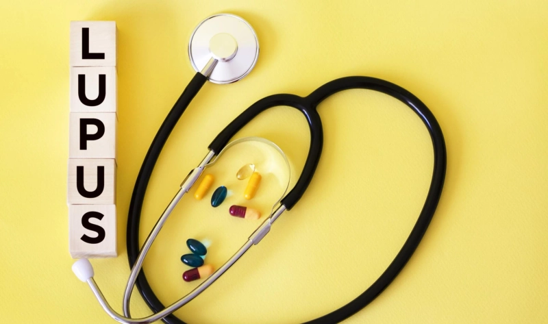 Explore New Treatments in Cutaneous Lupus Erythematosus Clinical Trials