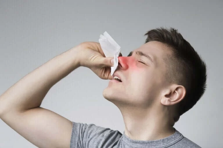 In The Winter Season, Upper Respiratory Infections Are More Likely To Occur, Resulting In Epistaxis