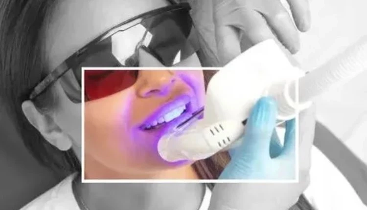 Top Tips to Maintain a Bright Smile After Teeth Whitening