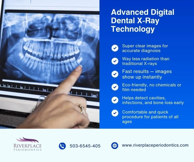 From Film to Digital: Evolution of Dental X-Ray Imaging