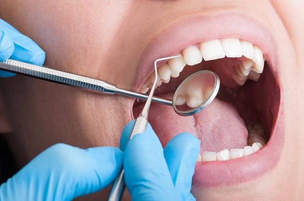 Proven Ways to Overcome Dental Anxiety and Stay Calm at the Dentist