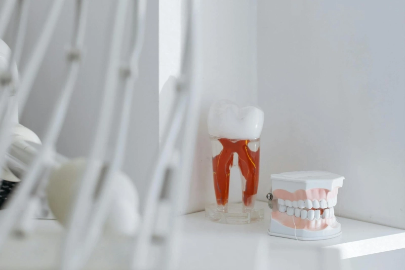Choosing Between Dental Crowns and Bridges: What San Mateo Patients Should Know