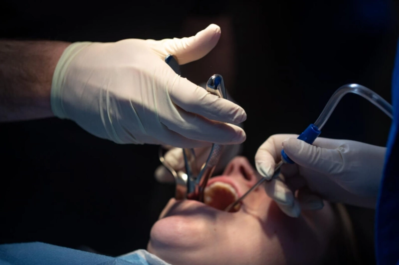 What to Expect During and After Wisdom Teeth Extraction Introduction