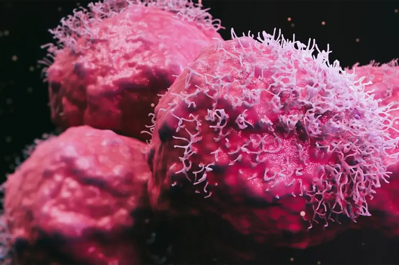 Utilizing PDX Models to Model Metastatic Breast Cancer