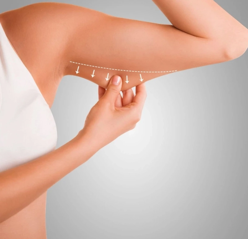 كيفية التحضير لعملية شد الذراعين في الرياض