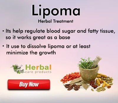 Herbal Treatment for Lipoma | Remedies | Herbal Care Products