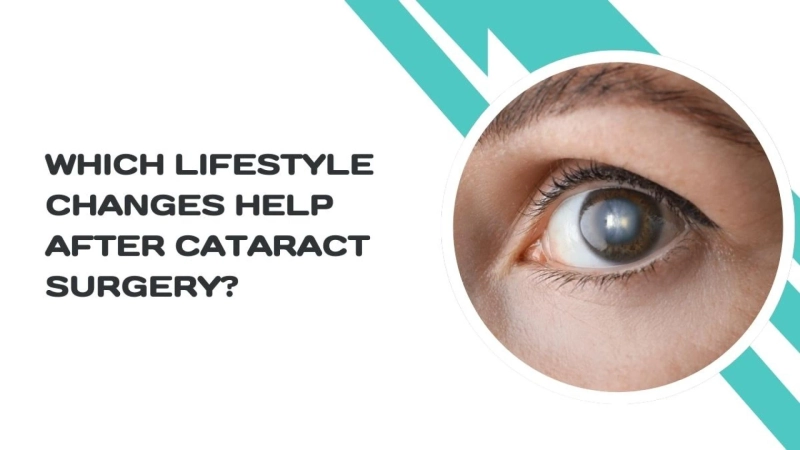 Which Lifestyle Changes Help After Cataract Surgery?