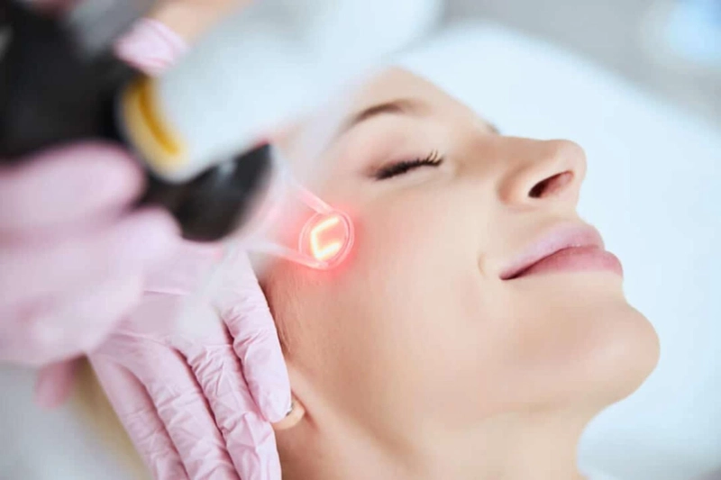 Laser Acne Scar Removal: Your Journey to Renewal