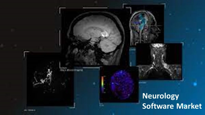 Neurology Software Market: High-growth Regions to Expand Geographic Footprint 2022-2030