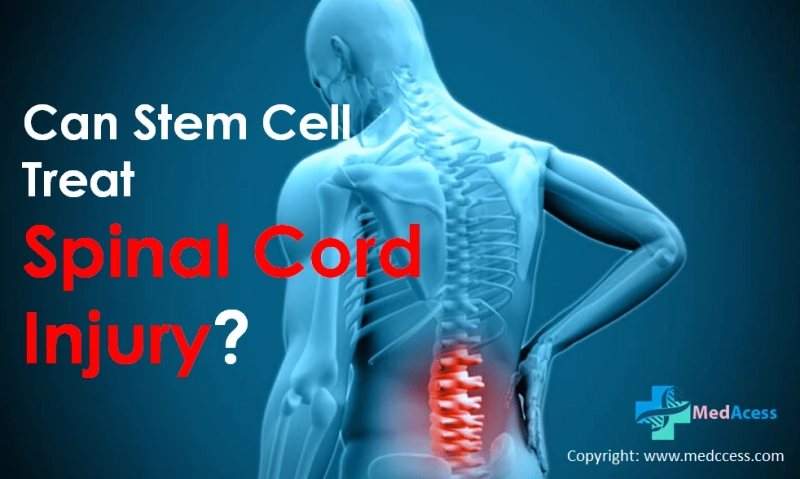 Zero Waiting Time Stem Cell Spinal Cord Injury Treatment in India