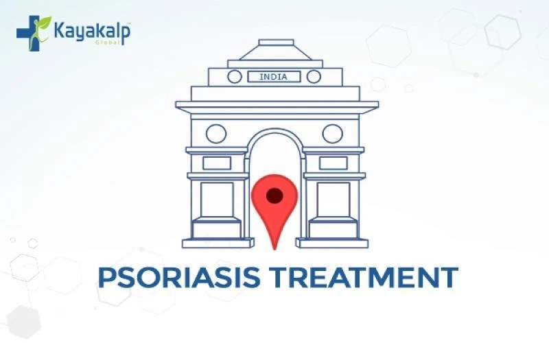 The Complete Guide to Psoriasis and Ayurvedic Treatment