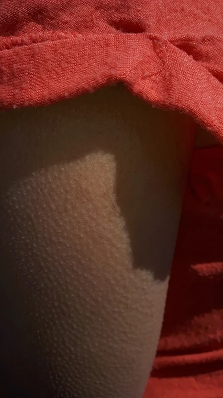 Wondering about goosebumps? Of course you are