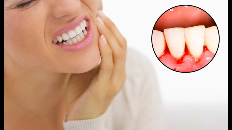 What Foods Should Be Avoided After Gum Treatment?