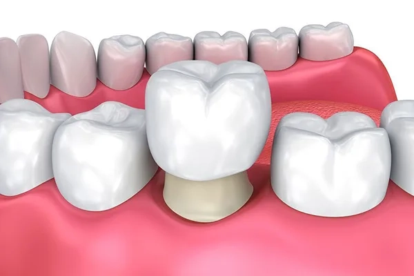 Choosing a Trusted Dentist in Dawsonville for Cosmetic Dentistry