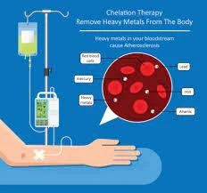 Chelation Therapy: Purpose & Procedure