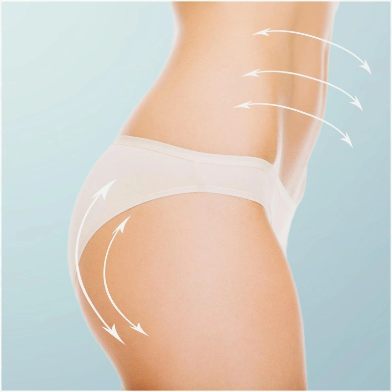 Liposuction Scars Minimizing Them Effectively